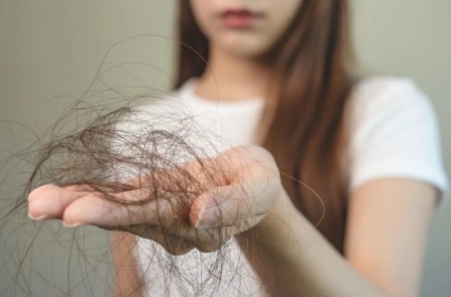 How Diet and Nutrition Impact Hair Loss
