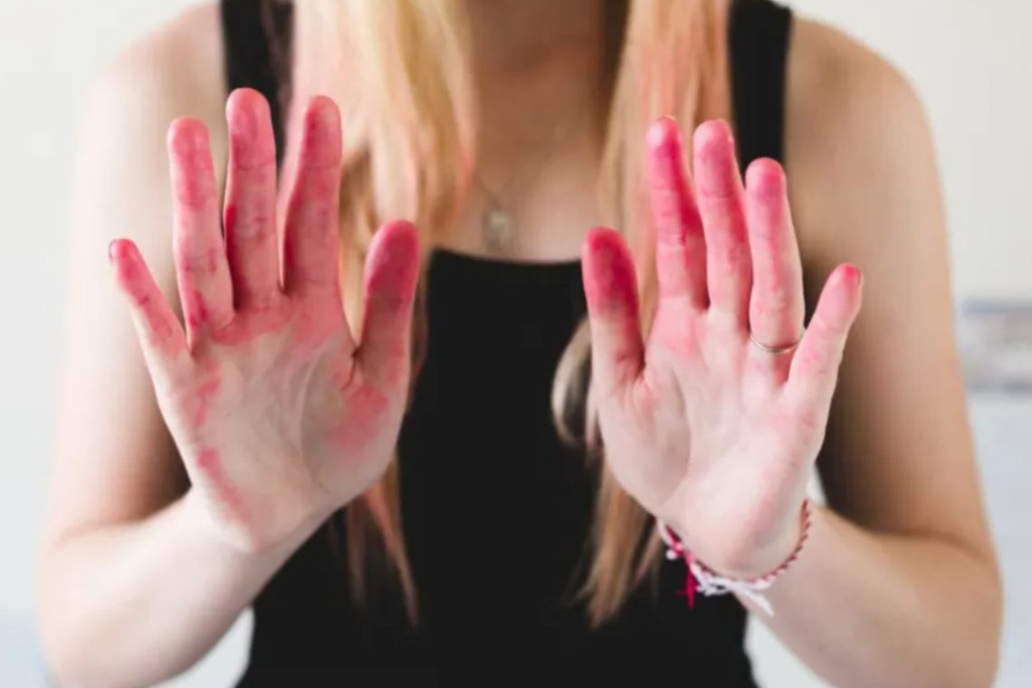 Ways to Remove Hair Dye from Skin Safely