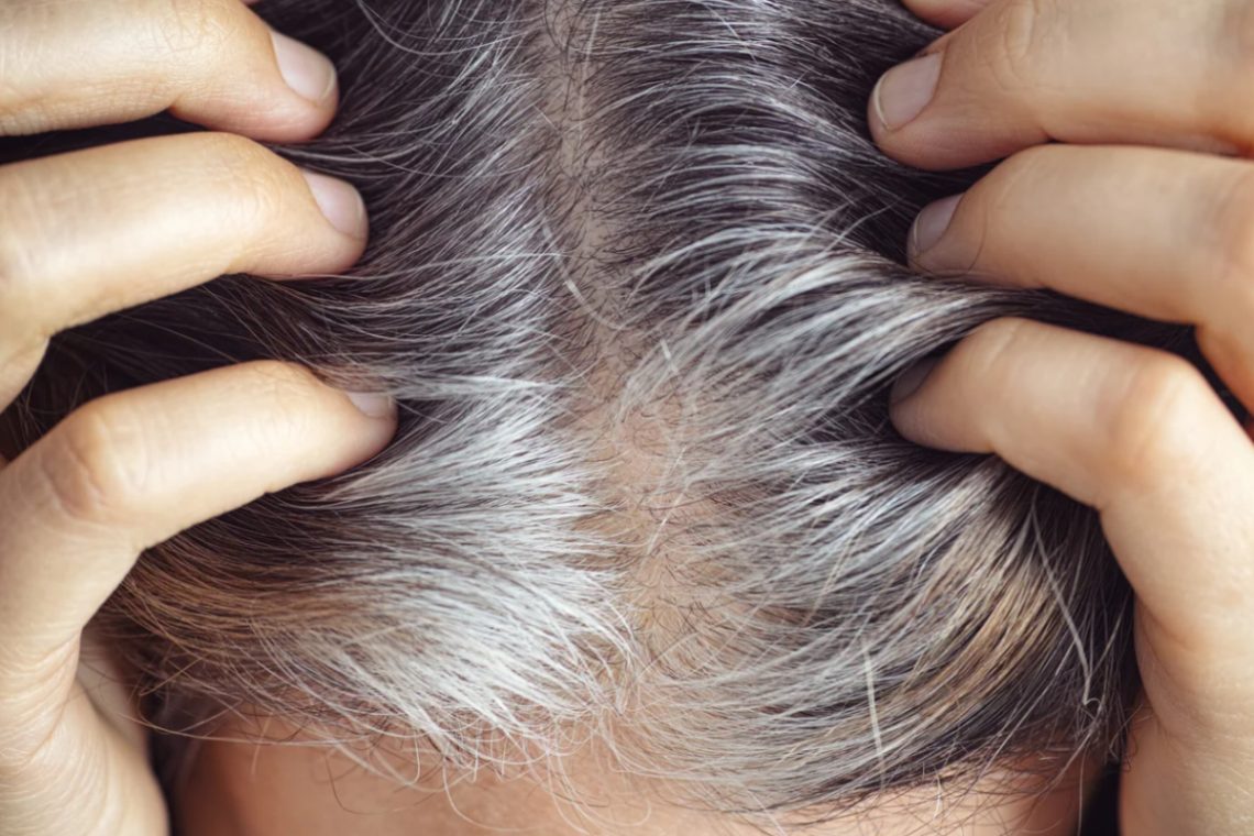 Why Hair Turns Grey and What Affects It