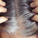 Why Hair Turns Grey and What Affects It