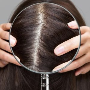 Understanding the Scalp Microbiome