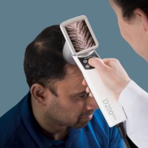What is an AI Hair Analysis